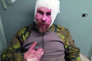 Český bojovník na Ukrajině Arisu: Západ se hádá a...